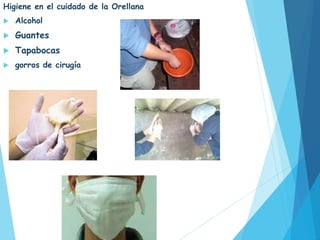Higiene en el cuidado de la Orellana
 Alcohol
 Guantes
 Tapabocas
 gorros de cirugía
Durante el desarrollo de esta, es necesario que el
sustrato contenga la humedad necesaria para el
desarrollo de la Orellana
 