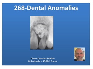 268-Dental Anomalies
Olivier Oussama SANDID
Orthodontist – SQODF- France
 