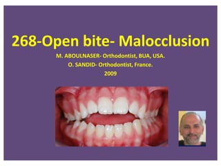 268-Open bite- Malocclusion
M. ABOULNASER- Orthodontist, BUA, USA.
O. SANDID- Orthodontist, France.
2009
 