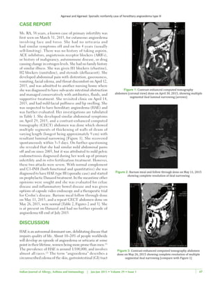 Agarwal and Agarwal: Sporadic nonfamily case of hereditary angioedema type III
47Indian Journal of Allergy, Asthma and Immunology | Jan-Jun 2015 • Volume 29 • Issue 1 47
CASE REPORT
Ms. RA, 38 years, a known case of primary infertility was
first seen on March 31, 2015, for cutaneous angioedema
involving face and torso. She had no urticaria and
had similar symptoms off and on for 4 years (usually
self‑limiting). There was no history of taking aspirin,
ACE inhibitors, angiotensin receptor blockers (ARB’s),
or history of malignancy, autoimmune disease, or drug
causing change in estrogen levels. She had no family history
of similar illness. She was given H1 blockers (ebastine),
H2 blockers (ranitidine), and steroids (deflazacort). She
developed abdominal pain with distention, gaseousness,
vomiting, facial edema, and throat discomfort on April 12,
2015, and was admitted to another nursing home where
she was diagnosed to have sub‑acute intestinal obstruction
and managed conservatively with antibiotics, fluids, and
supportive treatment. She revisited clinic on April 14,
2015, and had mild facial puffiness and lip swelling. She
was suspected to have hereditary angioedema (HAE) and
was further evaluated. Her investigations are tabulated
in Table 1. She developed similar abdominal symptoms
on April 29, 2015, and a contrast‑enhanced computed
tomography (CECT) abdomen was done which showed
multiple segments of thickening of walls of ileum of
varying length (longest being approximately 9 cm) with
resultant luminal narrowing [Figure 1]. She recovered
spontaneously within 3–5 days. On further questioning
she revealed that she had similar mild abdominal pains
off and on since 2003, but it was attributed to mild pelvic
endometriosis diagnosed during her work up of primary
infertility and in vitro fertilization treatment. However,
these two attacks were severe. With normal complement
and C1‑INH (both functional and quantitative) she was
diagnosed to have HAE type III (sporadic case) and started
on prophylactic Danazol treatment. In the meantime other
opinions were sought and she was evaluated for celiac
disease and inflammatory bowel disease and was given
options of capsule video endoscopy and a therapeutic trial
for Crohn’s disease. Barium meal follow through done
on May 11, 2015, and a repeat CECT abdomen done on
May 26, 2015, were normal [Table 2, Figures 2 and 3]. She
is at present on Danazol and had no further episode of
angioedema till end of July 2015.
DISCUSSION
HAE is an autosomal dominant rare, debilitating disease that
impairs quality of life. About 10–20% of people worldwide
will develop an episode of angioedema or urticaria at some
point in their lifetime, women being more prone than men.[1]
The prevalence of HAE is around 1/100,000, and involves
almost all races.[2]
The term “angioedema” describes a
circumscribed edema of the skin, gastrointestinal (GI) tract
Figure 1: Contrast‑enhanced computed tomography
abdomen (coronal view) done on April 30, 2015, showing multiple
segmental ileal luminal narrowing (arrows)
Figure 2: Barium meal and follow through done on May 11, 2015
showing complete resolution of ileal narrowing
Figure 3: Contrast‑enhanced computed tomography abdomen
done on May 26, 2015 showing complete resolution of multiple
segmental ileal narrowing [compare with Figure 1]
 
