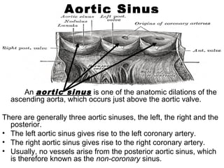 Aortic Sinus
An aortic sinus is one of the anatomic dilations of the
ascending aorta, which occurs just above the aortic valve.
There are generally three aortic sinuses, the left, the right and the
posterior.
• The left aortic sinus gives rise to the left coronary artery.
• The right aortic sinus gives rise to the right coronary artery.
• Usually, no vessels arise from the posterior aortic sinus, which
is therefore known as the non-coronary sinus.
 