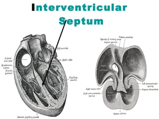 Interventricular
 Septum
 