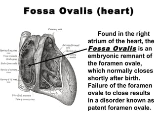 Fossa Ovalis (heart)
Found in the right
atrium of the heart, the
Fossa Ovalis is an
embryonic remnant of
the foramen ovale,
which normally closes
shortly after birth.
Failure of the foramen
ovale to close results
in a disorder known as
patent foramen ovale.
 