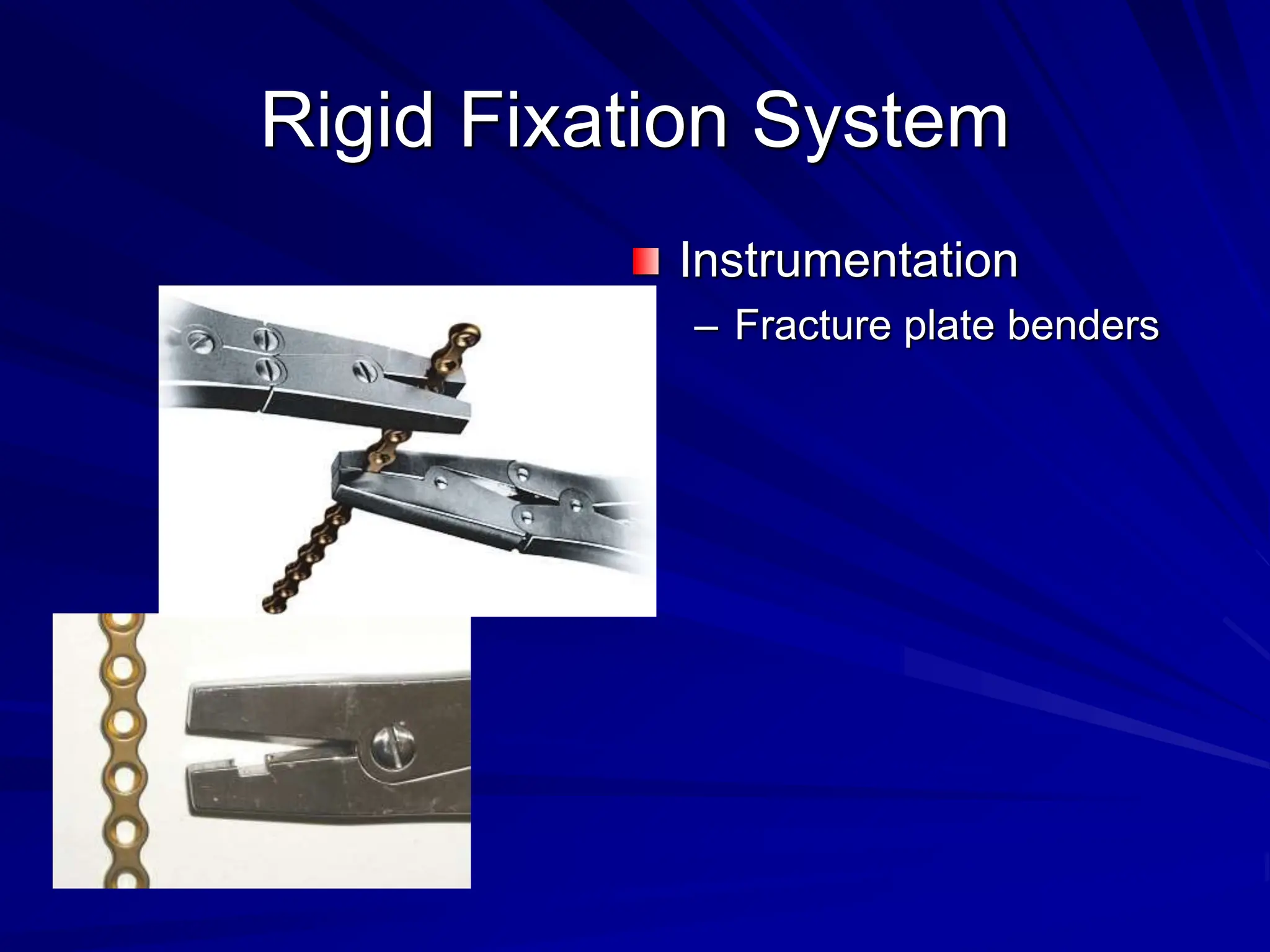 268307418-Management-of-Mandibular-fractures-ppt.ppt