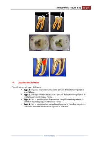 [ENDODONTIE	
  –	
  COURS	
  3	
  -­‐	
  6]	
   11	
  	
  /	
  56	
  
	
  
	
  	
  
Dadoo	
  DinCluj	
  
	
  
	
   	
  
	
  	
  	
   	
  
	
  
	
  
	
  
	
  
	
  
	
  	
   	
  
	
  
	
  
IV. Classification	
  de	
  Weine	
  
	
  
Classification	
  en	
  4	
  types	
  différents	
  :	
  
• Type	
  1	
  :	
  il	
  y	
  aura	
  toujours	
  un	
  seul	
  canal	
  partant	
  de	
  la	
  chambre	
  pulpaire	
  
jusqu’à	
  l’apex	
  
• Type	
  2	
  :	
  configuration	
  de	
  deux	
  canaux	
  partant	
  de	
  la	
  chambre	
  pulpaire	
  et	
  
se	
  réunissant	
  au	
  niveau	
  de	
  l’apex.	
  	
  
• Type	
  3	
  :	
  Sur	
  la	
  même	
  racine,	
  deux	
  canaux	
  complètement	
  séparés	
  de	
  la	
  
chambre	
  pulpaire	
  jusqu’au	
  niveau	
  de	
  l’apex.	
  	
  
• Type	
  4	
  :	
  Sur	
  la	
  même	
  racine,	
  un	
  seul	
  canal	
  part	
  de	
  la	
  chambre	
  pulpaire,	
  et	
  
celui-­‐ci	
  se	
  divise	
  en	
  deux	
  canaux	
  séparés	
  et	
  distincts.	
  
	
  	
  
	
  
	
  
 