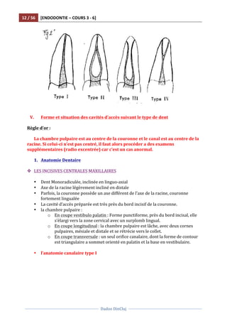 12	
  /	
  56	
   [ENDODONTIE	
  –	
  COURS	
  3	
  -­‐	
  6]	
  
	
  
	
  	
  
Dadoo	
  DinCluj	
  
	
  
	
   	
  
	
  
	
  
V. Forme	
  et	
  situation	
  des	
  cavités	
  d'accès	
  suivant	
  le	
  type	
  de	
  dent	
  
	
  	
  
Règle	
  d’or	
  :	
  	
  
	
  
La	
  chambre	
  pulpaire	
  est	
  au	
  centre	
  de	
  la	
  couronne	
  et	
  le	
  canal	
  est	
  au	
  centre	
  de	
  la	
  
racine.	
  Si	
  celui-­‐ci	
  n’est	
  pas	
  centré,	
  il	
  faut	
  alors	
  procéder	
  a	
  des	
  examens	
  
supplémentaires	
  (radio	
  excentrée)	
  car	
  c’est	
  un	
  cas	
  anormal.	
  
	
  
1. Anatomie	
  Dentaire	
  
	
  
v LES	
  INCISIVES	
  CENTRALES	
  MAXILLAIRES	
  
	
  	
  
• Dent	
  Monoradiculée,	
  inclinée	
  en	
  linguo-­‐axial	
  
• Axe	
  de	
  la	
  racine	
  légèrement	
  incliné	
  en	
  distale	
  
• Parfois,	
  la	
  couronne	
  possède	
  un	
  axe	
  différent	
  de	
  l’axe	
  de	
  la	
  racine,	
  couronne	
  
fortement	
  lingualée	
  
• La	
  cavité	
  d’accès	
  préparée	
  est	
  très	
  près	
  du	
  bord	
  incisif	
  de	
  la	
  couronne.	
  	
  
• la	
  chambre	
  pulpaire	
  :	
  	
  
o En	
  coupe	
  vestibulo	
  palatin	
  :	
  Forme	
  punctiforme,	
  près	
  du	
  bord	
  incisal,	
  elle	
  
s’élargi	
  vers	
  la	
  zone	
  cervical	
  avec	
  un	
  surplomb	
  lingual.	
  	
  
o En	
  coupe	
  longitudinal	
  :	
  la	
  chambre	
  pulpaire	
  est	
  lâche,	
  avec	
  deux	
  cornes	
  
pulpaires,	
  mésiale	
  et	
  distale	
  et	
  se	
  rétrécie	
  vers	
  le	
  collet.	
  
o En	
  coupe	
  transversale	
  :	
  un	
  seul	
  orifice	
  canalaire,	
  dont	
  la	
  forme	
  de	
  contour	
  
est	
  triangulaire	
  a	
  sommet	
  orienté	
  en	
  palatin	
  et	
  la	
  base	
  en	
  vestibulaire.	
  	
  
	
  
• l’anatomie	
  canalaire	
  type	
  I	
  
	
  
 