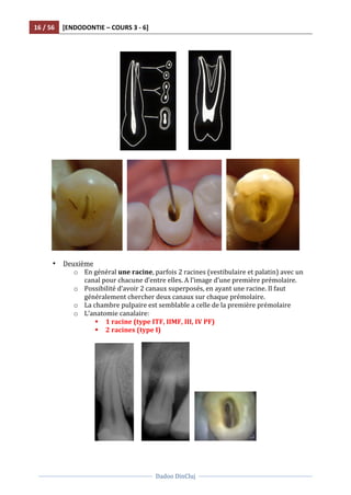 16	
  /	
  56	
   [ENDODONTIE	
  –	
  COURS	
  3	
  -­‐	
  6]	
  
	
  
	
  	
  
Dadoo	
  DinCluj	
  
	
  
	
   	
  
	
  	
  
	
  	
  	
  	
  	
  	
  	
  	
   	
  
	
  
	
  	
  	
   	
  	
  	
   	
  
	
  
• Deuxième	
  	
  
o En	
  général	
  une	
  racine,	
  parfois	
  2	
  racines	
  (vestibulaire	
  et	
  palatin)	
  avec	
  un	
  
canal	
  pour	
  chacune	
  d’entre	
  elles.	
  A	
  l’image	
  d’une	
  première	
  prémolaire.	
  	
  
o Possibilité	
  d’avoir	
  2	
  canaux	
  superposés,	
  en	
  ayant	
  une	
  racine.	
  Il	
  faut	
  
généralement	
  chercher	
  deux	
  canaux	
  sur	
  chaque	
  prémolaire.	
  	
  
o La	
  chambre	
  pulpaire	
  est	
  semblable	
  a	
  celle	
  de	
  la	
  première	
  prémolaire	
  
o L’anatomie	
  canalaire:	
  
§ 1	
  racine	
  (type	
  ITF,	
  IIMF,	
  III,	
  IV	
  PF)	
  
§ 2	
  racines	
  (type	
  I)	
  
	
  
	
  	
  	
  	
  	
   	
  	
  	
   	
  
	
  
 