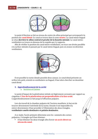 22	
  /	
  56	
   [ENDODONTIE	
  –	
  COURS	
  3	
  -­‐	
  6]	
  
	
  
	
  	
  
Dadoo	
  DinCluj	
  
	
  
	
   	
  
	
  
	
  
	
  
Le	
  point	
  d'élection	
  se	
  fait	
  au	
  niveau	
  du	
  centre	
  du	
  sillon	
  principal	
  qui	
  correspond	
  à	
  la	
  
position	
  du	
  canal	
  distal.	
  Ce	
  canal	
  se	
  trouve	
  dans	
  la	
  zone	
  neutre.	
  Le	
  canal	
  mésio-­‐lingual	
  
se	
  situe	
  derrière	
  le	
  sillon	
  central	
  et	
  proche	
  de	
  la	
  fossette	
  mésiale.	
  Le	
  canal	
  mésio-­‐
vestibulaire	
  se	
  trouve	
  en	
  dessous	
  de	
  la	
  cuspide	
  qui	
  s’y	
  rapporte.	
  	
  
Afin	
  de	
  vérifier	
  la	
  position	
  du	
  canal	
  mésio-­‐vestibulaire,	
  on	
  trace	
  une	
  droite	
  parallèle	
  
à	
  la	
  surface	
  mésiale	
  et	
  passant	
  par	
  le	
  canal	
  mésio-­‐lingual,	
  puis	
  on	
  avance	
  en	
  direction	
  
vestibulaire.	
  
	
  
	
  
	
  
Il	
  est	
  possible	
  la	
  racine	
  distale	
  possède	
  deux	
  canaux.	
  Le	
  canal	
  distal	
  présente	
  un	
  
orifice	
  très	
  petit,	
  orienté	
  en	
  vestibulaire	
  ou	
  lingual,	
  il	
  faut	
  alors	
  chercher	
  un	
  deuxième	
  
canal	
  distal.	
  	
  
	
  
3. Approfondissement	
  de	
  la	
  cavité	
  
a. Incisives	
  et	
  Canines	
  
	
  
Le	
  point	
  d'impact	
  de	
  la	
  pénétration	
  initiale	
  est	
  légèrement	
  coronaire	
  par	
  rapport	
  au	
  
cingulum.	
  L’Axe	
  de	
  la	
  pénétration	
  est	
  perpendiculaire	
  à	
  la	
  face	
  orale.	
  
L’approfondissement	
  se	
  fait	
  jusqu’à	
  l’effraction	
  pulpaire.	
  	
  
	
  
Lors	
  du	
  travail	
  de	
  la	
  chambre	
  pulpaire	
  de	
  l’incisive	
  maxillaire,	
  le	
  but	
  est	
  de	
  
trouver	
  directement	
  l’extrémité	
  de	
  la	
  racine.	
  Ensuite	
  il	
  est	
  impossible	
  d’y	
  
entrer	
  directement,	
  il	
  faut	
  procéder	
  à	
  l’élimination	
  des	
  deux	
  triangles,	
  
vestibulaire	
  amélo-­‐dentinaire	
  et	
  palatin	
  dentinaire.	
  
	
  
A	
  ce	
  stade,	
  l’accès	
  primaire	
  détermine	
  avec	
  les	
  	
  sommets	
  des	
  cornes	
  
pulpaires,	
  2	
  triangles	
  qu’il	
  faut	
  éliminer.	
  	
  
• Il	
  faut	
  éliminer	
  les	
  deux	
  triangle	
  afin	
  d’avoir	
  un	
  accès	
  direct	
  au	
  
niveau	
  du	
  canal.	
  
 