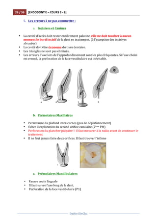 26	
  /	
  56	
   [ENDODONTIE	
  –	
  COURS	
  3	
  -­‐	
  6]	
  
	
  
	
  	
  
Dadoo	
  DinCluj	
  
	
  
	
   	
  
5. Les	
  erreurs	
  à	
  ne	
  pas	
  commettre	
  :	
  
	
  
a. Incisives	
  et	
  Canines	
  
	
  
• La	
  cavité	
  d’accès	
  doit	
  rester	
  entièrement	
  palatine,	
  elle	
  ne	
  doit	
  toucher	
  à	
  aucun	
  
moment	
  le	
  bord	
  incisif	
  de	
  la	
  dent	
  en	
  traitement.	
  (à	
  l’exception	
  des	
  incisives	
  
abrasées)	
  
• La	
  cavité	
  doit	
  être	
  économe	
  du	
  tissu	
  dentaire.	
  
• Les	
  triangles	
  ne	
  sont	
  pas	
  éliminés.	
  	
  
• Les	
  erreurs	
  d’axe	
  lors	
  de	
  l’approfondissement	
  sont	
  les	
  plus	
  fréquentes.	
  Si	
  l’axe	
  choisi	
  
est	
  erroné,	
  la	
  perforation	
  de	
  la	
  face	
  vestibulaire	
  est	
  inévitable.	
  
	
  
	
  
	
  
b. Prémolaires	
  Maxillaires	
  	
  
	
  
• Persistance	
  du	
  plafond	
  inter-­‐cornes	
  (pas	
  de	
  déplafonnement)	
  
• Echec	
  d’exploration	
  du	
  second	
  orifice	
  canalaire	
  (2ème	
  PM)	
  
• Perforation	
  du	
  plancher	
  pulpaire	
  !!	
  il	
  faut	
  mesurer	
  à	
  la	
  radio	
  avant	
  de	
  continuer	
  le	
  
traitement.	
  
• Il	
  ne	
  faut	
  jamais	
  faire	
  deux	
  orifices.	
  Il	
  faut	
  trouver	
  l’isthme	
  
	
  	
  	
  	
  	
  	
  	
  	
  	
   	
  
	
  
c. Prémolaires	
  Mandibulaires	
  
	
  
• Fausse	
  route	
  linguale	
  
• Il	
  faut	
  suivre	
  l’axe	
  long	
  de	
  la	
  dent.	
  	
  
• Perforation	
  de	
  la	
  face	
  vestibulaire	
  (P1)	
  
	
  
 