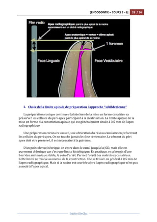[ENDODONTIE	
  –	
  COURS	
  3	
  -­‐	
  6]	
   33	
  	
  /	
  56	
  
	
  
	
  	
  
Dadoo	
  DinCluj	
  
	
  
	
   	
  
	
  
	
  
	
  
2. Choix	
  de	
  la	
  limite	
  apicale	
  de	
  préparation	
  l’approche	
  ‘’schilderienne’’	
  
	
  
La	
  préparation	
  conique	
  continue	
  réalisée	
  lors	
  de	
  la	
  mise	
  en	
  forme	
  canalaire	
  va	
  
préserver	
  les	
  cellules	
  du	
  péri-­‐apex	
  participant	
  à	
  la	
  cicatrisation.	
  La	
  limite	
  apicale	
  de	
  la	
  
mise	
  en	
  forme	
  =la	
  constriction	
  apicale	
  qui	
  est	
  généralement	
  située	
  à	
  0,5	
  mm	
  de	
  l'apex	
  
radiographique	
  
	
  
Une	
  préparation	
  coronaire	
  assure,	
  une	
  obturation	
  du	
  réseau	
  canalaire	
  en	
  préservant	
  
les	
  cellules	
  du	
  péri-­‐apex.	
  On	
  ne	
  touche	
  jamais	
  le	
  cône	
  cémentaire.	
  Le	
  cément	
  du	
  péri	
  
apex	
  doit	
  etre	
  préservé,	
  il	
  est	
  nécessaire	
  à	
  la	
  guérison.	
  	
  
	
  
D’un	
  point	
  de	
  vu	
  théorique,	
  on	
  entre	
  dans	
  le	
  canal	
  jusqu’à	
  la	
  JCD,	
  mais	
  elle	
  est	
  
purement	
  théorique	
  car	
  c’est	
  une	
  limite	
  histologique.	
  En	
  pratique,	
  on	
  a	
  besoin	
  d’une	
  
barrière	
  anatomique	
  stable,	
  le	
  coin	
  d’arrêt.	
  Permet	
  l’arrêt	
  des	
  matériaux	
  canalaires.	
  
Cette	
  limite	
  se	
  trouve	
  au	
  niveau	
  de	
  la	
  constriction.	
  Elle	
  se	
  trouve	
  en	
  général	
  à	
  0,5	
  mm	
  de	
  
l’apex	
  radiographique.	
  Mais	
  si	
  la	
  racine	
  est	
  courbée	
  alors	
  l’apex	
  radiographique	
  n’est	
  pas	
  
associé	
  à	
  l’apex	
  apical.	
  	
  
	
  	
  
 