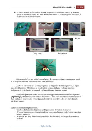 [ENDODONTIE	
  –	
  COURS	
  3	
  -­‐	
  6]	
   39	
  	
  /	
  56	
  
	
  
	
  	
  
Dadoo	
  DinCluj	
  
	
  
	
   	
  
4) La	
  limite	
  apicale	
  se	
  fait	
  en	
  fonction	
  de	
  la	
  constriction	
  (distance	
  entre	
  le	
  foramen	
  
apical	
  et	
  la	
  constriction	
  =	
  0,5	
  mm).	
  Pour	
  déterminer	
  la	
  vraie	
  longueur	
  de	
  travail,	
  il	
  
faut	
  alors	
  diminuer	
  de	
  0.5	
  mm.	
  
	
  
	
  
	
  
	
  
	
  
	
  
	
  
	
  
Cet	
  appareil	
  n’est	
  pas	
  utilisé	
  pour	
  réaliser	
  des	
  mesures	
  directes,	
  mais	
  pour	
  savoir	
  
si	
  la	
  longueur	
  estimée	
  sera	
  trop	
  courte	
  ou	
  trop	
  longue.	
  	
  
	
  
Au	
  fur	
  et	
  à	
  mesure	
  que	
  la	
  lime	
  progresse	
  la	
  fréquence	
  du	
  bip	
  augmente,	
  la	
  ligne	
  
associée	
  à	
  la	
  valeur	
  0,5	
  indique	
  la	
  constriction	
  apicale.	
  La	
  ligne	
  verte	
  est	
  aussi	
  un	
  
indicateur	
  de	
  cette	
  limite.	
  La	
  valeur	
  0	
  est	
  la	
  position	
  du	
  foramen	
  apical.	
  
	
  
Lorsque	
  l’apex	
  est	
  franchi,	
  une	
  indication	
  supplémentaire	
  commence	
  à	
  clignoter	
  
(ligne	
  rouge)	
  et	
  le	
  bip	
  devient	
  continu.	
  On	
  retire	
  la	
  lime	
  alors	
  pour	
  retrouver	
  la	
  valeur	
  0.	
  
Puis	
  on	
  tire	
  de	
  nouveau	
  (1	
  –	
  2	
  mm)	
  pour	
  atteindre	
  la	
  zone	
  bleue.	
  On	
  est	
  alors	
  dans	
  la	
  
partie	
  coronaire.	
  	
  
	
  
	
  
Contre-­‐indications	
  et	
  précautions	
  :	
  
• Isolation	
  de	
  la	
  dent	
  indispensable	
  (Digue)	
  sinon	
  déviation	
  du	
  courant	
  
• Déposer	
  les	
  anciennes	
  obturations	
  (couronnes,	
  amalgames,	
  caries),	
  provoque	
  des	
  
fausses	
  mesures.	
  	
  
• Irrigation	
  pas	
  trop	
  abondante	
  (possibilité	
  de	
  déviation),	
  on	
  les	
  garde	
  seulement	
  
humide.	
  
	
  	
   	
  	
  
	
  	
  
Trop	
  Long	
   Trop	
  Court	
  
FA/CA	
  
 
