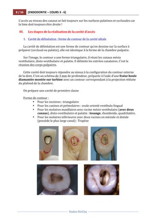 8	
  /	
  56	
   [ENDODONTIE	
  –	
  COURS	
  3	
  -­‐	
  6]	
  
	
  
	
  	
  
Dadoo	
  DinCluj	
  
	
  
	
   	
  
L’accès	
  au	
  niveau	
  des	
  canaux	
  se	
  fait	
  toujours	
  sur	
  les	
  surfaces	
  palatines	
  et	
  occlusales	
  car	
  
la	
  lime	
  doit	
  toujours	
  être	
  droite	
  !	
  
	
  
III. Les	
  étapes	
  de	
  la	
  réalisation	
  de	
  la	
  cavité	
  d'accès	
  
	
  	
   	
  
1. Cavité	
  de	
  délinéation	
  :	
  forme	
  de	
  contour	
  de	
  la	
  cavité	
  idéale	
  
	
  
La	
  cavité	
  de	
  délinéation	
  est	
  une	
  forme	
  de	
  contour	
  qu’on	
  dessine	
  sur	
  la	
  surface	
  à	
  
préparer	
  (occlusal	
  ou	
  palatin),	
  elle	
  est	
  identique	
  à	
  la	
  forme	
  de	
  la	
  chambre	
  pulpaire.	
  
	
  
Sur	
  l’image,	
  le	
  contour	
  a	
  une	
  forme	
  triangulaire,	
  il	
  réuni	
  les	
  canaux	
  mésio	
  
vestibulaire,	
  disto-­‐vestibulaire	
  et	
  palatin.	
  Il	
  délimite	
  les	
  entrées	
  canalaires.	
  C’est	
  la	
  
réunion	
  des	
  corps	
  pulpaires.	
  
	
  
Cette	
  cavité	
  doit	
  toujours	
  répondre	
  au	
  mieux	
  à	
  la	
  configuration	
  du	
  contour	
  externe	
  
de	
  la	
  dent.	
  C’est	
  un	
  schéma	
  de	
  3	
  mm	
  de	
  profondeur,	
  préparée	
  à	
  l’aide	
  d’une	
  fraise	
  boule	
  
diamantée	
  montée	
  sur	
  turbine	
  avec	
  un	
  contour	
  correspondant	
  à	
  la	
  projection	
  réduite	
  
du	
  plafond	
  de	
  la	
  chambre.	
  	
  
	
  
On	
  prépare	
  une	
  cavité	
  de	
  première	
  classe	
  
	
  
Forme	
  de	
  contour	
  :	
  
• Pour	
  les	
  incisives	
  :	
  triangulaire	
  	
  
• Pour	
  les	
  canines	
  et	
  prémolaires	
  :	
  ovale	
  orienté	
  vestibulo-­‐lingual	
  	
  
• Pour	
  les	
  molaires	
  maxillaires	
  avec	
  racine	
  mésio	
  vestibulaire	
  (avec	
  deux	
  
canaux),	
  disto-­‐vestibulaire	
  et	
  palatin	
  :	
  losange,	
  rhomboïde,	
  quadrilatère.	
  	
  
• Pour	
  les	
  molaires	
  inférieures	
  avec	
  deux	
  racines	
  en	
  mésiale	
  et	
  distale	
  
(possède	
  le	
  plus	
  large	
  canal)	
  :	
  Trapèze	
  
	
  
	
  	
  	
  	
  	
  	
   	
  	
  	
  	
   	
  
	
  
	
  	
  	
  	
  	
  	
  	
  	
  	
   	
  	
  
	
  
 