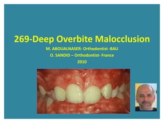 269-Deep Overbite Malocclusion
M. ABOUALNASER- Orthodontist -BAU
O. SANDID – Orthodontist- France
2010
 