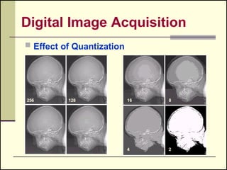 Distance measures in Image in Digital Image Processing | PPTX