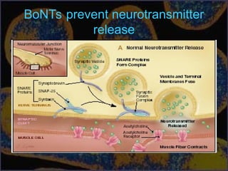 BoNTs prevent neurotransmitter
release
 