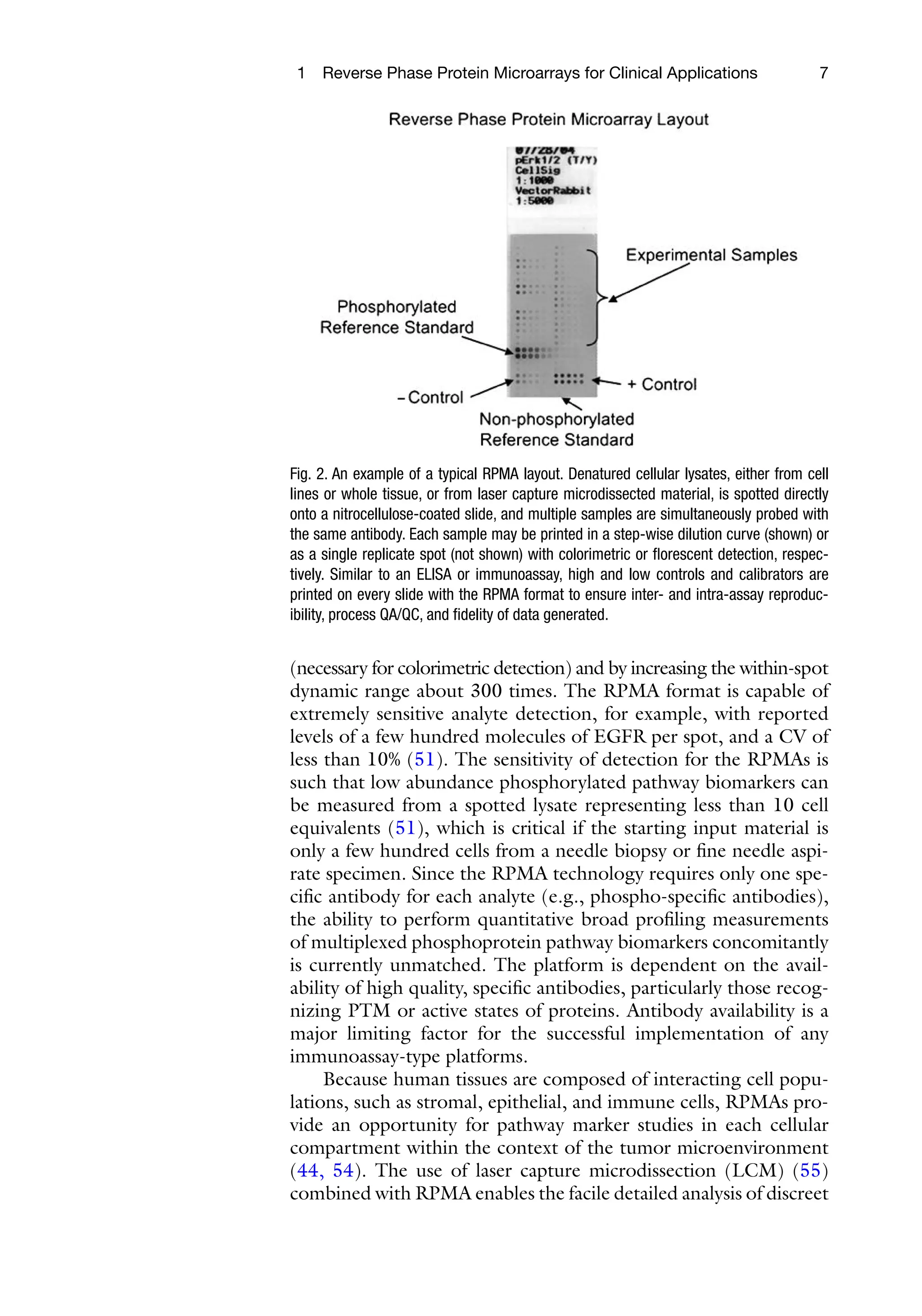 7
1 Reverse Phase Protein Microarrays for Clinical Applications
(necessary for colorimetric detection) and by increasing the within-spot
dynamic range about 300 times. The RPMA format is capable of
extremely sensitive analyte detection, for example, with reported
levels of a few hundred molecules of EGFR per spot, and a CV of
less than 10% (51). The sensitivity of detection for the RPMAs is
such that low abundance phosphorylated pathway biomarkers can
be measured from a spotted lysate representing less than 10 cell
equivalents (51), which is critical if the starting input material is
only a few hundred cells from a needle biopsy or fine needle aspi-
rate specimen. Since the RPMA technology requires only one spe-
cific antibody for each analyte (e.g., phospho-specific antibodies),
the ability to perform quantitative broad profiling measurements
of multiplexed phosphoprotein pathway biomarkers concomitantly
is currently unmatched. The platform is dependent on the avail-
ability of high quality, specific antibodies, particularly those recog-
nizing PTM or active states of proteins. Antibody availability is a
major limiting factor for the successful implementation of any
immunoassay-type platforms.
Because human tissues are composed of interacting cell popu-
lations, such as stromal, epithelial, and immune cells, RPMAs pro-
vide an opportunity for pathway marker studies in each cellular
compartment within the context of the tumor microenvironment
(44, 54). The use of laser capture microdissection (LCM) (55)
combined with RPMA enables the facile detailed analysis of ­
discreet
Fig. 2. An example of a typical RPMA layout. Denatured cellular lysates, either from cell
lines or whole tissue, or from laser capture microdissected material, is spotted directly
onto a nitrocellulose-coated slide, and multiple samples are simultaneously probed with
the same antibody. Each sample may be printed in a step-wise dilution curve (shown) or
as a single replicate spot (not shown) with colorimetric or florescent detection, respec-
tively. Similar to an ELISA or immunoassay, high and low controls and calibrators are
printed on every slide with the RPMA format to ensure inter- and intra-assay reproduc-
ibility, process QA/QC, and fidelity of data generated.
 