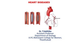 HEART DISEASES
Dr. T.Sakthika
Assistant Professor
Department of Zoology
A.P.C.Mahalaxmi College for Women,
Thoothukudi
 