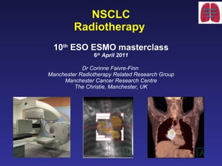 NSCLC R adiotherapy   10 th  ESO ESMO masterclass 6 th  April 2011 Dr Corinne Faivre-Finn  Manchester Radiotherapy Related Research Group Manchester Cancer Research Centre The Christie, Manchester, UK 