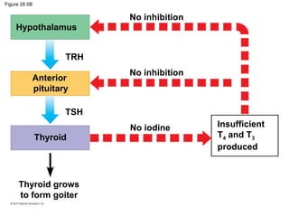 Figure 26.5B
Hypothalamus
No inhibition
No inhibition
No iodine Insufficient
T4 and T3
produced
Thyroid grows
to form goiter
TSH
Anterior
pituitary
TRH
Thyroid
 