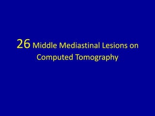 26Middle Mediastinal Lesions on
Computed Tomography
 