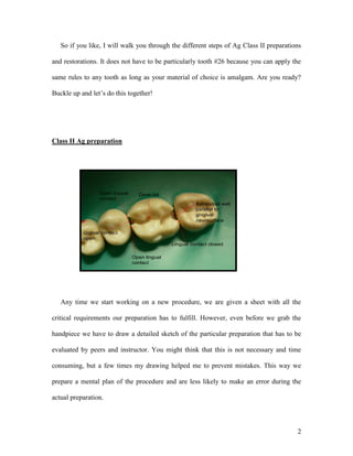 So if you like, I will walk you through the different steps of Ag Class II preparations

and restorations. It does not have to be particularly tooth #26 because you can apply the

same rules to any tooth as long as your material of choice is amalgam. Are you ready?

Buckle up and let’s do this together!




Class II Ag preparation




                 Open buccal     Dove tail
                 contact
                                                        Axiopulpal wall
                                                        parallel to
                                                        gingival
                                                        cavosurface

           Gigival contact
           open
                                              Lingual contact closed

                               Open lingual
                               contact




   Any time we start working on a new procedure, we are given a sheet with all the

critical requirements our preparation has to fulfill. However, even before we grab the

handpiece we have to draw a detailed sketch of the particular preparation that has to be

evaluated by peers and instructor. You might think that this is not necessary and time

consuming, but a few times my drawing helped me to prevent mistakes. This way we

prepare a mental plan of the procedure and are less likely to make an error during the

actual preparation.



                                                                                        2
 