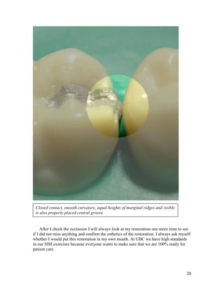 Closed contact, smooth curvature, equal heights of marginal ridges and visible
 is also properly placed central groove.


     After I check the occlusion I will always look at my restoration one more time to see
if I did not miss anything and confirm the esthetics of the restoration. I always ask myself
whether I would put this restoration in my own mouth. At UBC we have high standards
in our SIM exercises because everyone wants to make sure that we are 100% ready for
patient care.




                                                                                         20
 