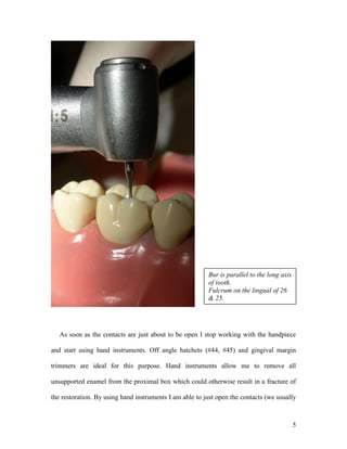 Bur is parallel to the long axis
                                                         of tooth.
                                                         Fulcrum on the lingual of 26
                                                         & 25.




   As soon as the contacts are just about to be open I stop working with the handpiece

and start using hand instruments. Off angle hatchets (#44, #45) and gingival margin

trimmers are ideal for this purpose. Hand instruments allow me to remove all

unsupported enamel from the proximal box which could otherwise result in a fracture of

the restoration. By using hand instruments I am able to just open the contacts (we usually



                                                                                            5
 