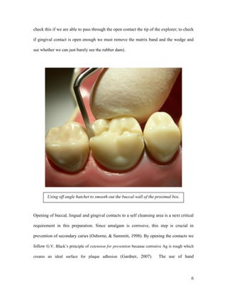 check this if we are able to pass through the open contact the tip of the explorer; to check

if gingival contact is open enough we must remove the matrix band and the wedge and

see whether we can just barely see the rubber dam).




        Using off angle hatchet to smooth out the buccal wall of the proximal box.



Opening of buccal, lingual and gingival contacts to a self cleansing area is a next critical

requirement in this preparation. Since amalgam is corrosive, this step is crucial in

prevention of secondary caries (Osborne, & Summitt, 1998). By opening the contacts we

follow G.V. Black’s principle of extension for prevention because corrosive Ag is rough which

creates an ideal surface for plaque adhesion (Gardner, 2007).           The use of hand



                                                                                           6
 