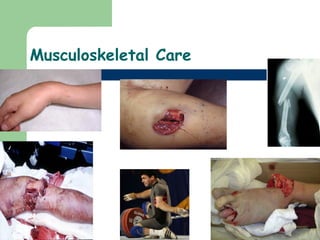 Musculoskeletal Care 