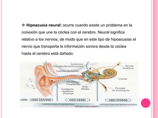  Hipoacusia neural: ocurre cuando existe un problema en la
conexión que une la cóclea con el cerebro. Neural significa
relativo a los nervios, de modo que en este tipo de hipoacusias el
nervio que transporta la información sonora desde la cóclea
hasta el cerebro está dañado.

 