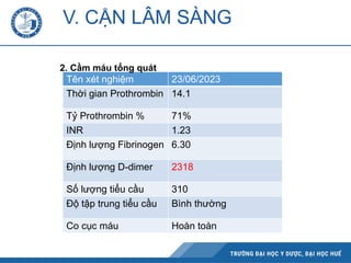 Tên xét nghiệm 23/06/2023
Thời gian Prothrombin 14.1
Tỷ Prothrombin % 71%
INR 1.23
Định lượng Fibrinogen 6.30
Định lượng D-dimer 2318
Số lượng tiểu cầu 310
Độ tập trung tiểu cầu Bình thường
Co cục máu Hoàn toàn
V. CẬN LÂM SÀNG
2. Cầm máu tổng quát
 