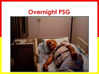Overnight PSG
 