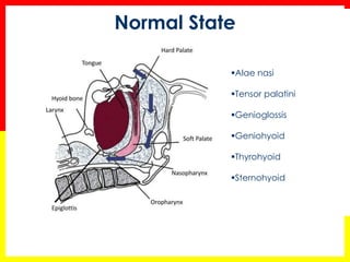 Alae nasi
Tensor palatini
Genioglossis
Geniohyoid
Thyrohyoid
Sternohyoid
Normal State
 