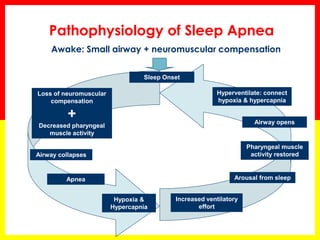Pathophysiology of Sleep Apnea
Awake: Small airway + neuromuscular compensation
Loss of neuromuscular
compensation
+
Decreased pharyngeal
muscle activity
Sleep Onset
Hyperventilate: connect
hypoxia & hypercapnia
Airway opens
Airway collapses
Pharyngeal muscle
activity restored
Apnea Arousal from sleep
Hypoxia &
Hypercapnia
Increased ventilatory
effort
 