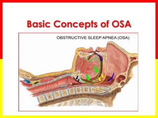 Basic Concepts of OSA
 