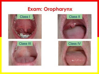 Exam: Oropharynx
Class I
Class III
Class II
Class IV
 