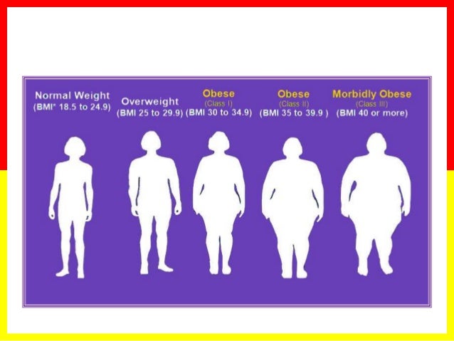obstructive sleep apnea diagnostic considerations neck size sleep apnea