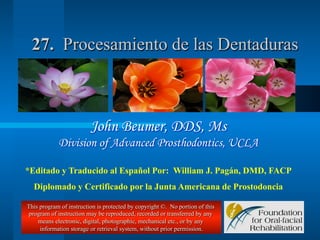 27. Procesamiento de las Dentaduras

John Beumer, DDS, Ms
Division of Advanced Prosthodontics, UCLA
*Editado y Traducido al Español Por: William J. Pagán, DMD, FACP
Diplomado y Certificado por la Junta Americana de Prostodoncia
This program of instruction is protected by copyright ©. No portion of this
program of instruction may be reproduced, recorded or transferred by any
means electronic, digital, photographic, mechanical etc., or by any
information storage or retrieval system, without prior permission.

 