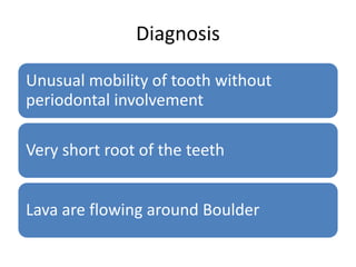 Diagnosis
Unusual mobility of tooth without
periodontal involvement
Very short root of the teeth
Lava are flowing around Boulder
 