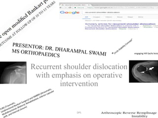 Recurrent shoulder dislocation
with emphasis on operative
intervention
engaging Hill-Sachs lesio
DPS
 