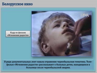 В ряде документальных лент нашла отражение чернобыльская тематика. Теле-
фильм «Мгновения радости» рассказывает о больных детях, находящихся в
больнице после чернобыльской аварии.
Кадр из фильма
«Мгновения радости»
 