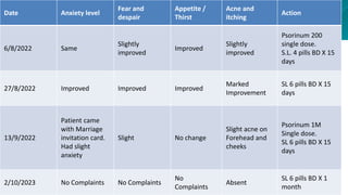 Case of Acne by KENT METHOD | PPTX