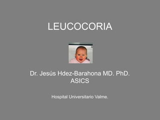LEUCOCORIA
Dr. Jesús Hdez-Barahona MD. PhD.
ASICS
Hospital Universitario Valme.
 