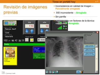 Tórax en portátil hoy:                        p.17



   Revisión de imágenes      • Inconsistencia en calidad de Imagen –
                              Parcialmente arreglado
   previas                   • SID inconsistente - Arreglado
                             • Sin parrilla
                             • Inconsistencia en factores de la técnica
                              radiográfica- Arreglado




Public
© 2011, Carestream Health
 