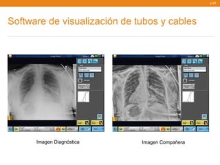 p.24




Software de visualización de tubos y cables




      Imagen Diagnóstica      Imagen Compañera
 