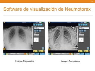 p.25




Software de visualización de Neumotorax




     Imagen Diagnóstica   Imagen Compañera
 