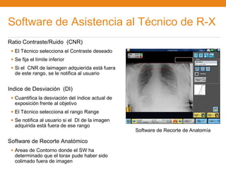 Software de Asistencia al Técnico de R-X
Ratio Contraste/Ruido (CNR)
 • El Técnico selecciona el Contraste deseado
 • Se fija el límite inferior
 • Si el CNR de laimagen adquierida está fuera
  de este rango, se le notifica al usuario


Indice de Desviación (DI)
 • Cuantifica la desviación del índice actual de
  exposición frente al objetivo
 • El Técnico selecciona el rango Range
 • Se notifica al usuario si el DI de la imagen
  adquirida está fuera de ese rango
                                                   Software de Recorte de Anatomía

Software de Recorte Anatómico
 • Areas de Contorno donde el SW ha
  determinado que el torax pude haber sido
  colimado fuera de imagen
 