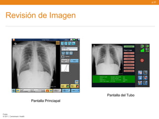 p.31




   Revisión de Imagen




                                                  Pantalla del Tubo
                            Pantalla Princiapal


Public
© 2011, Carestream Health
 