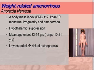 Weight-related amenorrhoea Anorexia Nervosa A body mass index (BMI) <17  kg/m ²   menstrual irregularity and amenorrhea Hypothalamic  suppression  Mean age onset 13-14 yrs (range 10-21 yrs) Low estradiol    risk of osteoporosis 
