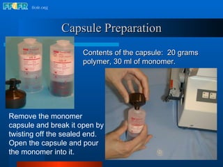 Capsule Preparation Contents of the capsule:  20 grams  polymer, 30 ml of monomer. Remove the monomer capsule and break it open by twisting off the sealed end.  Open the capsule and pour the monomer into it. 